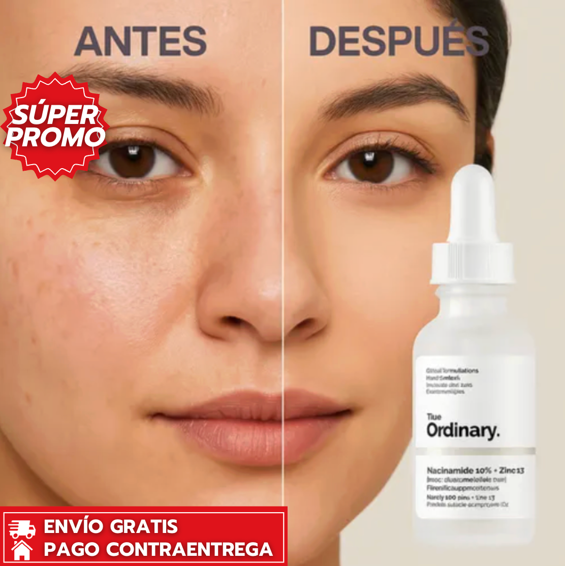 Oferta Especial 2x1: KIT ORDINARY™ – Exfoliación Suave + Control de Imperfecciones para una Piel Más Luminosa y Equilibrada
