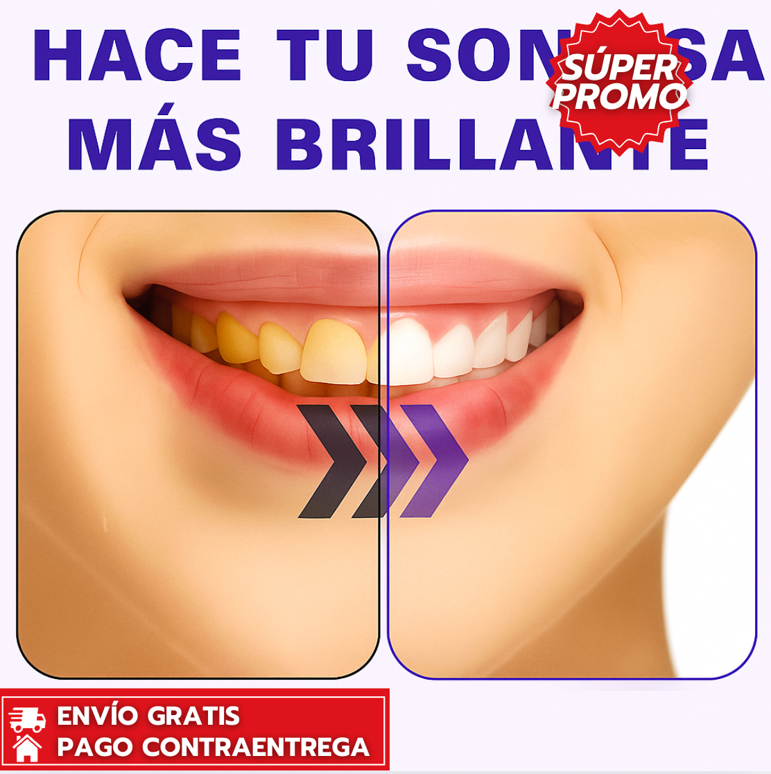 HiSmile™: Blanqueador dental sin peróxido que aclara manchas y devuelve el brillo natural a tu sonrisa.