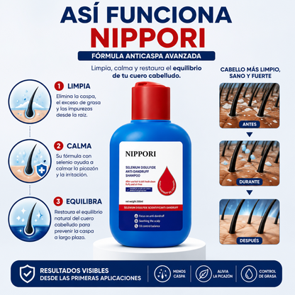 2X1 Oferta Especial NIPPORI™: Controla Grasa, Elimina Caspa, Calma Picazón