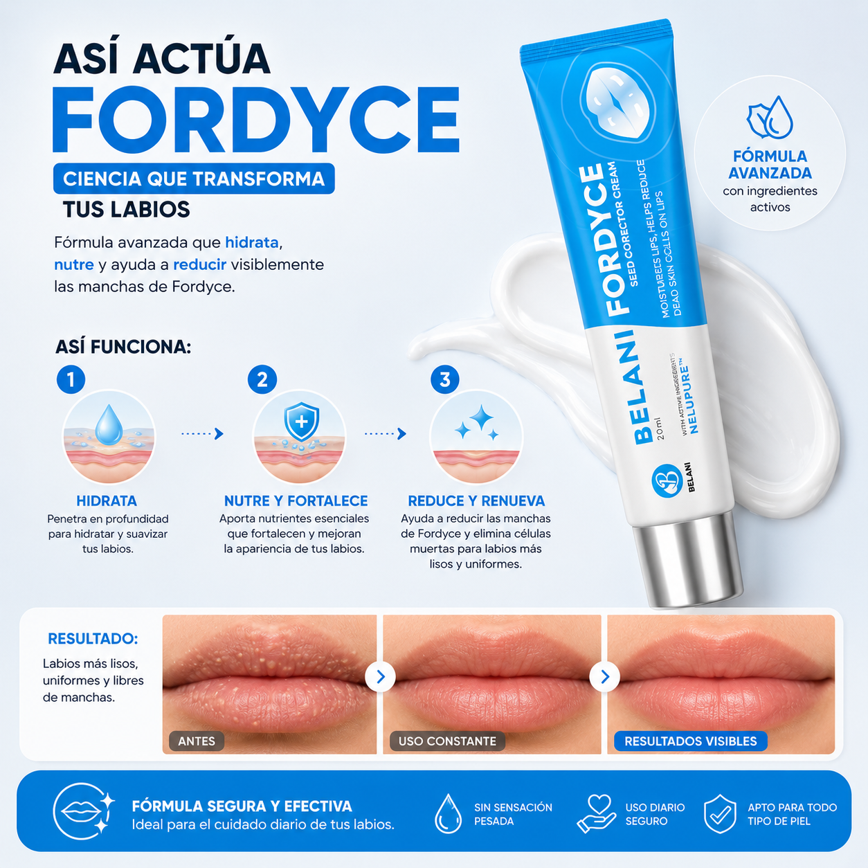 Belany Fordyce™: Dile Adiós a Los Puntitos y Las Manchas en Tus Labios
