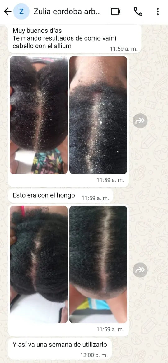 Experiencia de un cliente